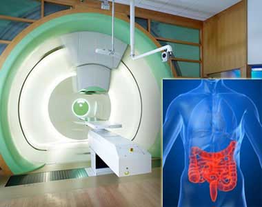 Best Colon Cancer Hospital In India