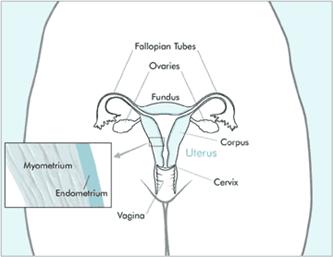 Intro Endometrial Cancer India