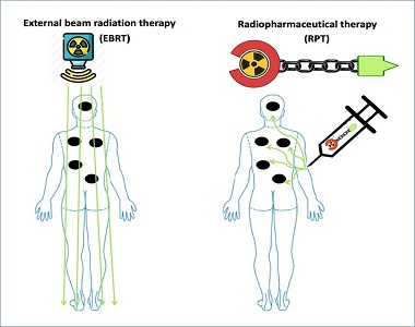 radionuclide therapy india 